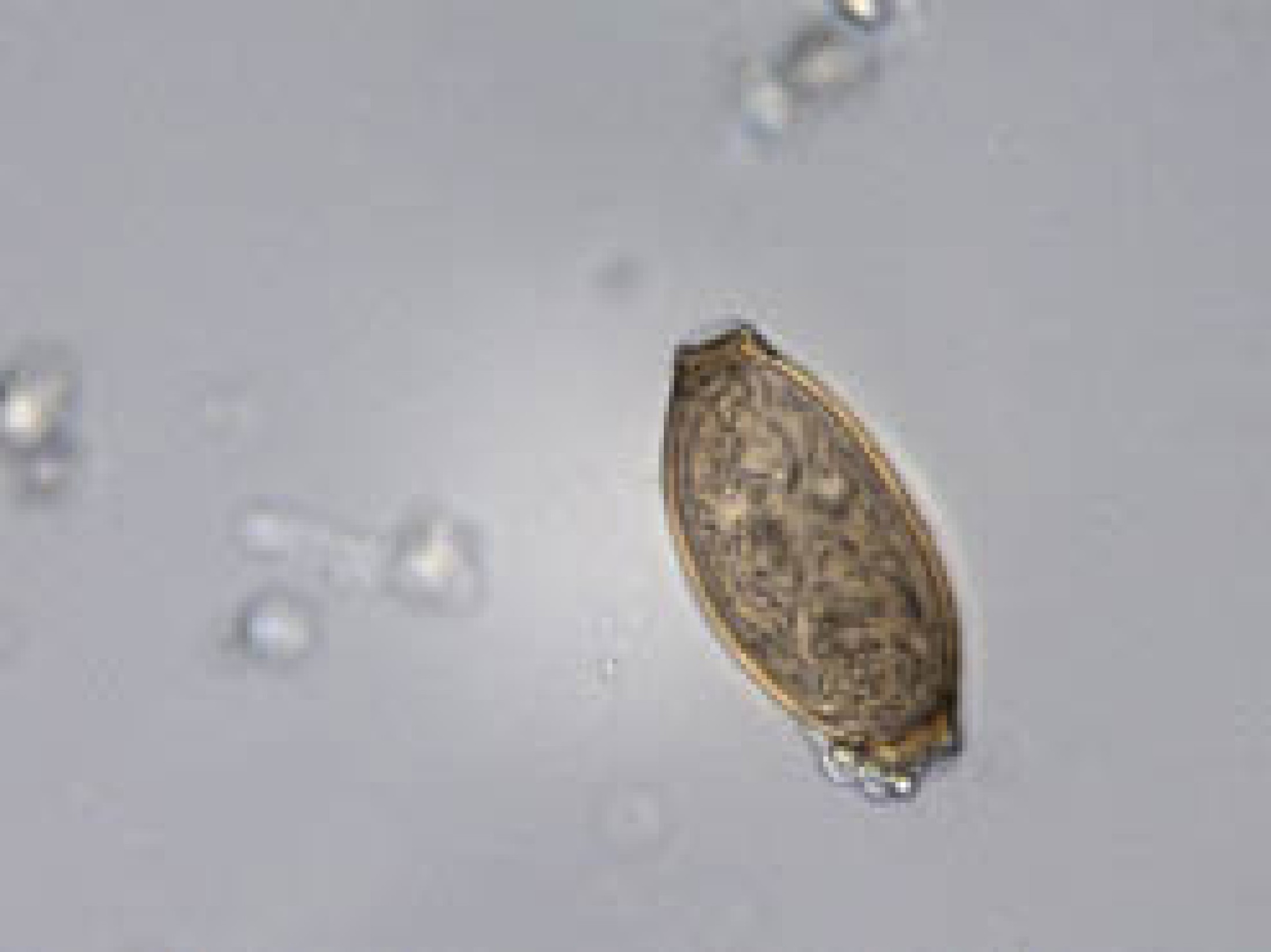 : Ei eines Peitschenwurms aus menschlichen Exkrementen aus dem prähistorischen Salzbergbau (Länge 0,05 mm). (Bild: Chr. Hörweg - NHM Wien)