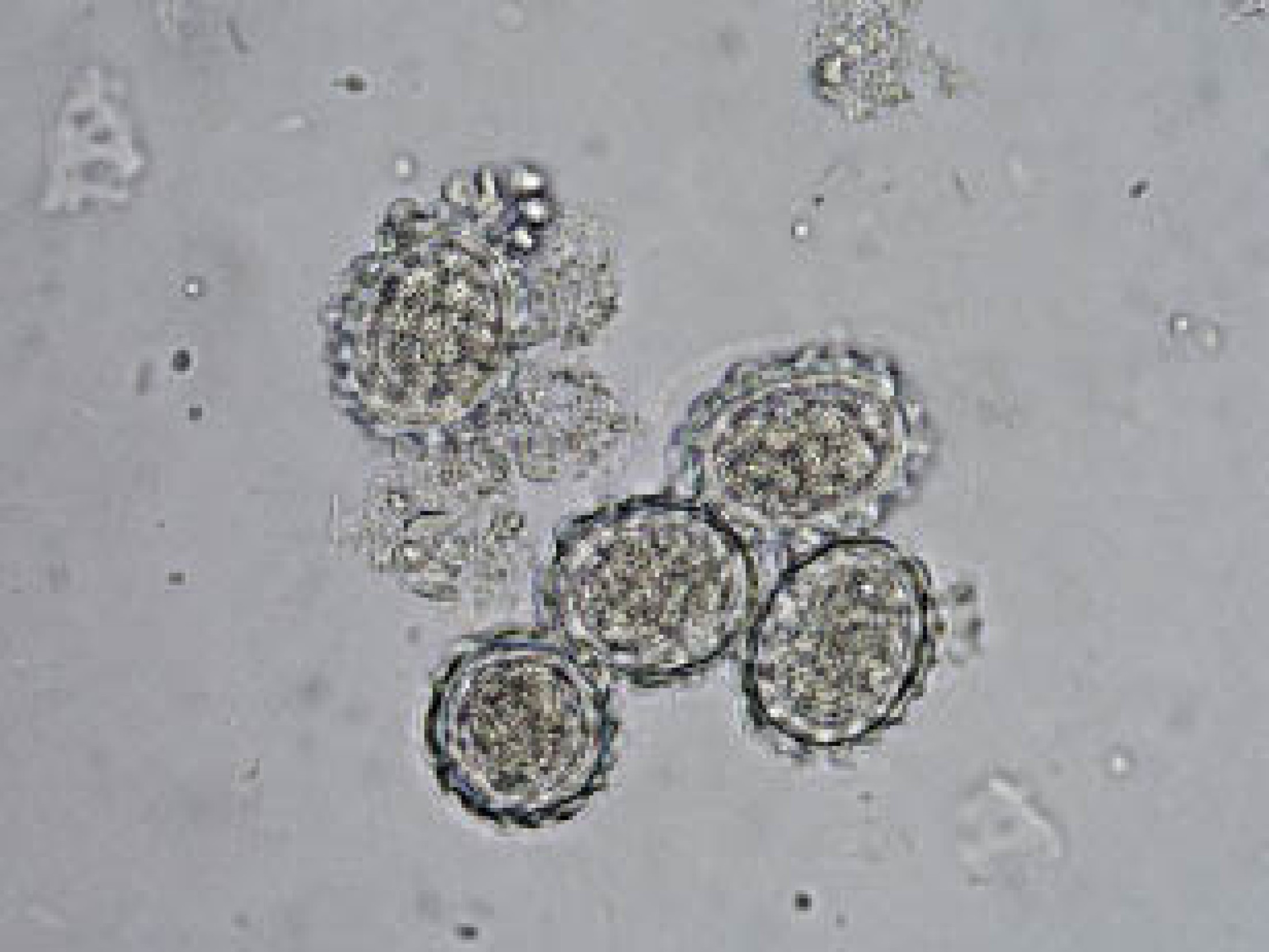 : Spulwurm-Eier aus menschlichen Exkrementen (Länge 0,06 mm). (Bild: Chr. Hörweg - NHM Wien)
