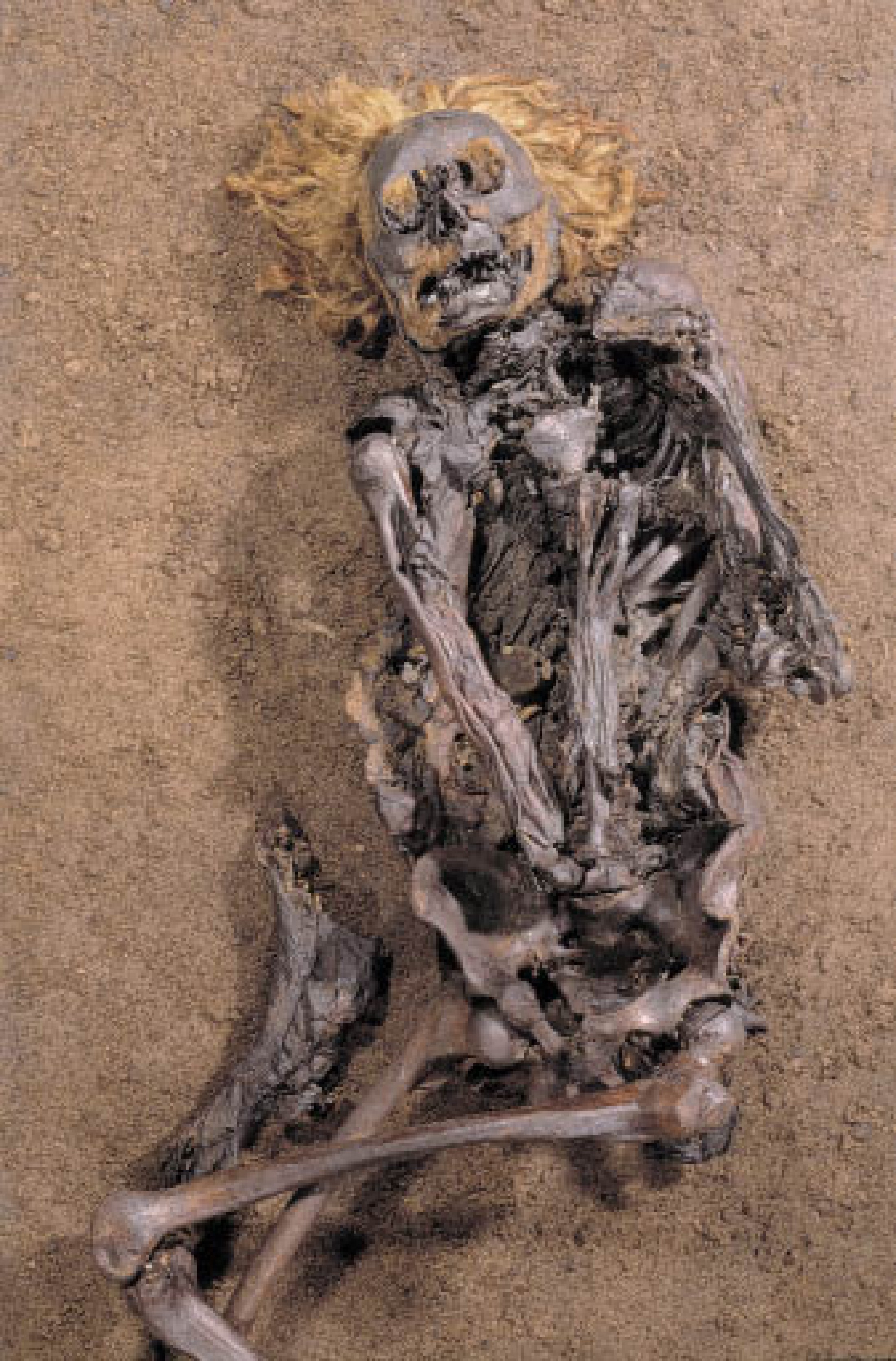 : Der rote Franz: Immer wieder werden in den nordeuropäischen Mooren mumifizierte Körper prähistorischer Menschen entdeckt. Viele dieser Leichen weisen schwere Verletzungen auf. Der „rote Franz“ starb an einer Schnittverletzung im Halsbereich. Die Radiokarbon-Datierung ergab, dass er aus dem 3. oder 4. Jahrhundert n. Chr. stammt. Sein ursprünglich blondes Haar wurde erst durch das Moorwasser rot gefärbt. Nach seiner Entdeckung wurde der Körper zunächst, wie der „Mann im Salz“, am Friedhof bestattet. Heute befindet er sich im Niedersächsischen Landesmuseum in Hannover. (Bild: Niedersächsiches Landesmuseum Hannover)