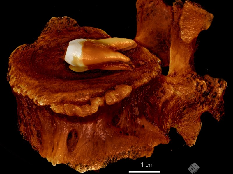 Farbige Volumendarstellung eines menschlichen Backenzahns und Wirbelknochens zur Bestimmung des Gesundheitszustandes von prähistorischen Skeletten. Quick-Scan (34,6 µm / 20 min): Farbige Volumendarstellung eines menschlichen Backenzahns und Wirbelknochens zur Bestimmung des Gesundheitszustandes von prähistorischen Skeletten. Quick-Scan (34,6 µm / 20 min)