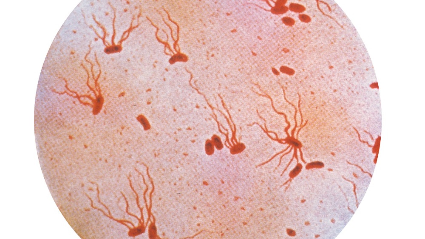 Typhuserreger Typhuserreger | © Public Health Library
(PHIL)